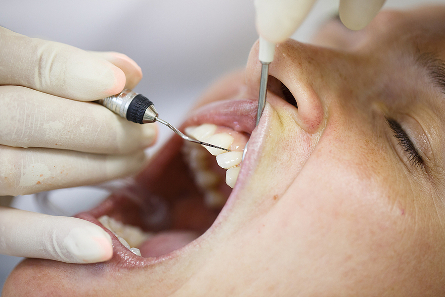 Comprehensive Periodontal Therapy in Springfield, MO: Restore Your Gum Health